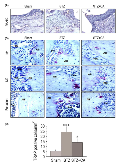 Effect of CA on (A) STZ-induced RANKL expression and (B, C) osteoclast formation in AB