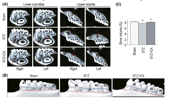 Effect of CA on STZ-induced periodontitic alveolar bone degradation