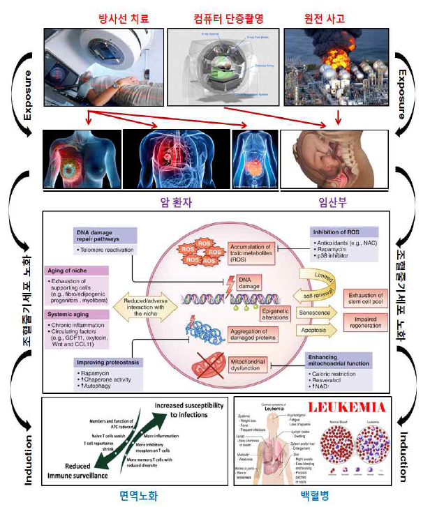 방사능 노출 시 조혈줄기세포 노화에 의한 추가적 발생 질환