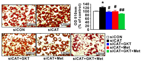 Oil-red O staining of siCAT transfected 3T3-L1 with GKT137831 or/and metformin (n=3). The data were expressed as the mean ± SEM, Student’s t-test, *P < 0.05, **P < 0.01, ***P < 0.001 versus siCON transfected 3T3-L1 group; #P < 0.05, ##P < 0.01, ###P < 0.001 versus siCAT transfected 3T3-L1 group