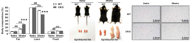 (A) Body composition (%) of WT and CKO mice at 5 and 30 weeks of age. (B) Representative pictures of WT and CKO mice at 5 and 30 weeks of age. (C) H Student’s t-test, n = 10, ***P < 0.001 versus WT mice; tttP < 0.001, 5-week-old WT mice versus 30-week-old WT mice; $$$P < 0.001, 5-week-old CKO mice versus 30-week-old CKO mice