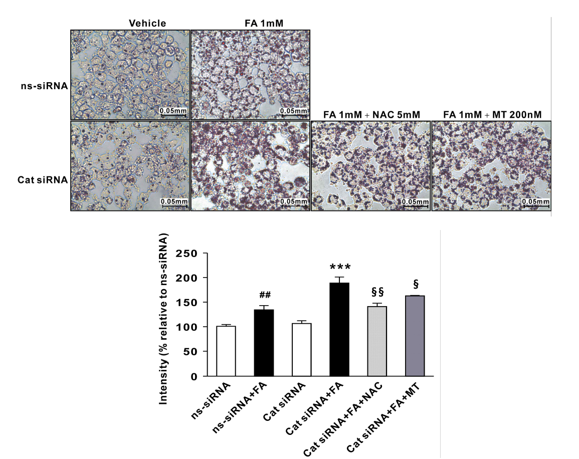 Oil-red O (ORO) staining of HepG2 cells exposed to a 1 mM FA for 24 h in the presence of 5 mM N-acetyl-L-cysteine (NAC) or 200 nM melatonin (MT; ×200) and ORO staining intensity of HepG2 cells. n = 3–5 ##P < 0.01 vs. ns-siRNA; ***P < 0.001 vs. ns-siRNA-FA; §P < 0.05, §§P < 0.01 vs. Cat siRNA-FA. Small interfering RNA, siRNA