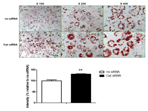 Oil-red O (ORO) staining of 3T3-L1 cells transfected with control (ns-siRNA) or catalase siRNA (Cat siRNA), and ORO staining intensity of 3T3-L1 cells. n = 3–6 **P < 0.01 vs. ns-siRNA. Small interfering RNA, siRNA