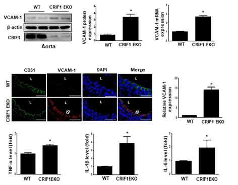 CRIF1 KO 마우스에서 VCAM-1 및 cytokines 를 증가시킴