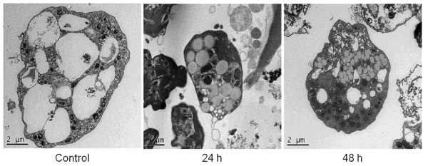 솔잎 열수추출물에 의한 파울러자유아메바의 미세 세포구조 변화 규명을 위한 TEM 분석 결과