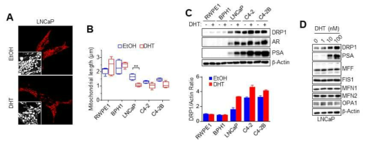 엔드로겐 신호에 따른 미토콘드리아 분열 단백질 DRP1의 변화