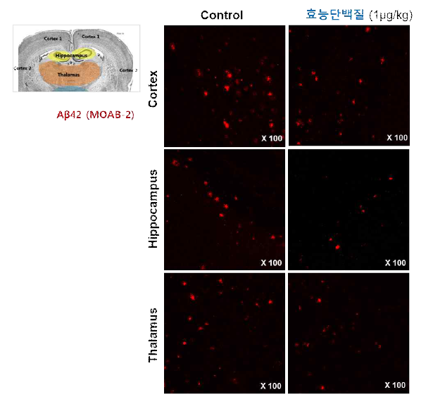 ‘효능단백질’ 투여에 의한 질환동물모델 뇌 내 아밀로이드 감소 면역형광법으로 확인