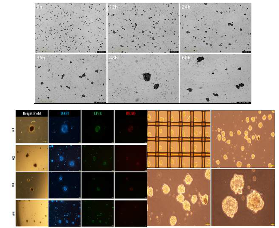 스페로이드의 크기별 세포 생존율 확인 및 균일한 고품질 줄기세포 3D 생산 시스템 구축