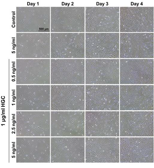 HGC 및 다양한 농도의 bFGF 처리 후 세포 사진