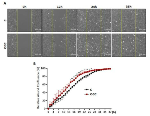 Wound healing assay