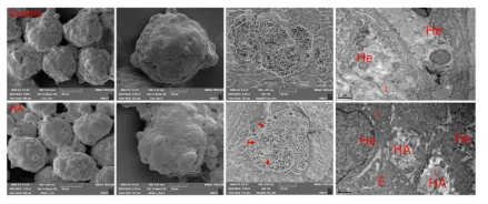 스페로이드의 SEM과 TEM 분석. 붉은 화살표가 히알루론산 미립구를 가르킴. HA: 히알루론산 미립구, L: 지질, E: ECM