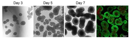 ULA에서 7일간 배양된 스페로이드의 형태 및 live/dead 결과