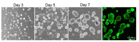 히알루론산 미립구를 이용하여 7일간 배양된 스페로이드의 형태 및 live/dead 결과