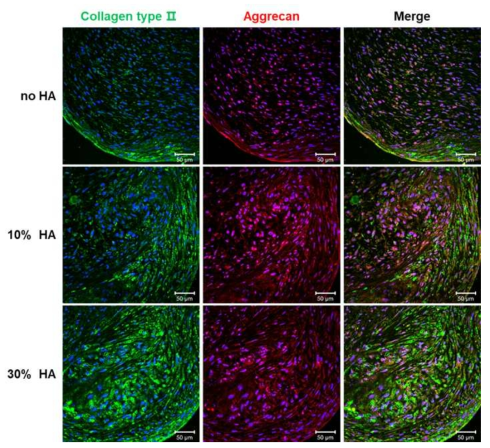 Collagen type II와 aggrecan의 면역염색 결과