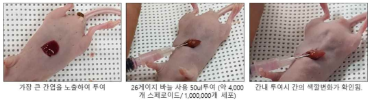 간세포주로 구성된 스페로이드의 간 이식