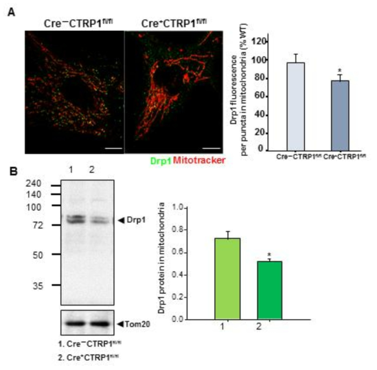 CTRP1이 Drp1의 미토콘드리아 유입에 관여함