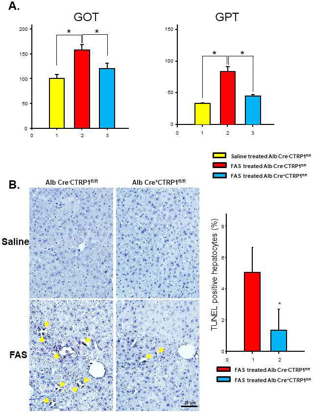 간의 FAS 유도 독성실험에서 CTRP1의 세포사멸 미치는 역할
