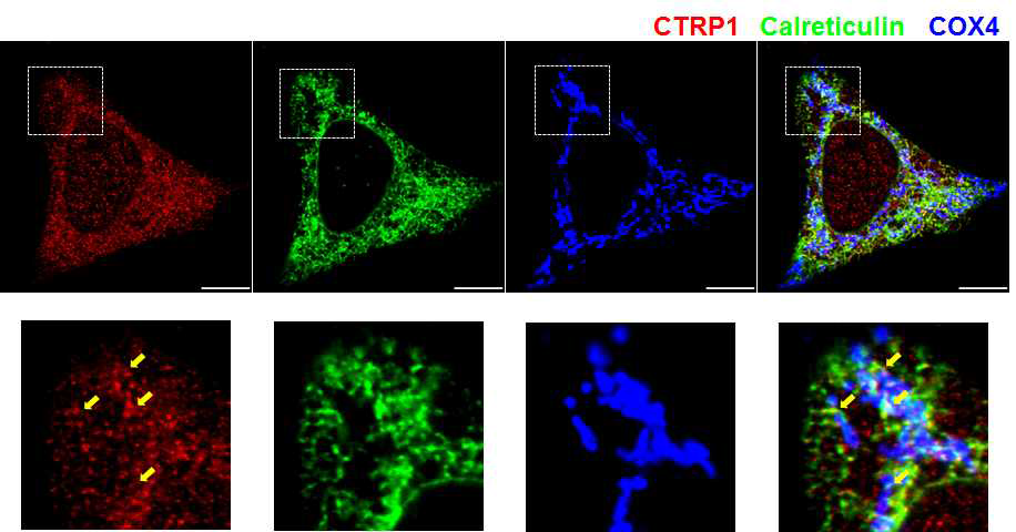 CTRP1은 소포체에 존재함