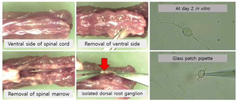 DRG neuron 분리과정 및 분리한 single neuron의 in vitro 배양 후 발생된 신경돌기