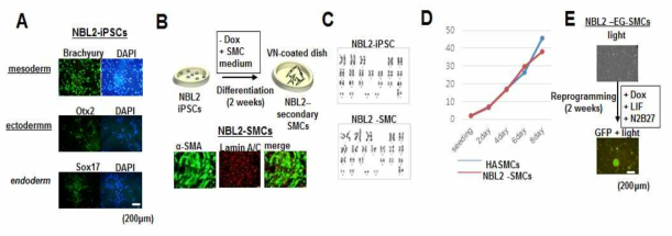 NBL2-iPSC로부터 리프로그래밍 세포주 수립. A) NBL2-iPSC의 in vitro 삼배엽 분화. B) NBL2-iPSC의 SMC 분화 모식도. VN, vitronectin. C) karyotype analysis. D) NBL2-SMC의 성장도 조사. E) NBL2-EG-SMC의 리프로그램능 조사