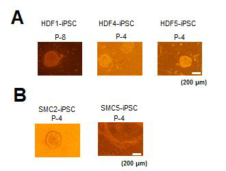 OSKM 함유 센다이바이러스를 이용한 iPSC 제작 A) 인간피부세포를 이용한 iPSC 제작. B) 인간평활근세포를 이용한 iPSC 제작