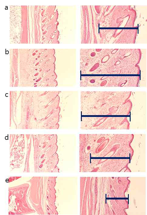 Histological images of the dorsal pedis skin
