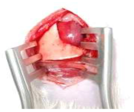 좌전하행동맥(left anterior descending artery)을 묶어서 혈류흐름을 막아 심근경색을 유도한 모습. 혈류가 차단된 부분의 조직 색깔이 선홍색에서 분홍색으로 변색됨