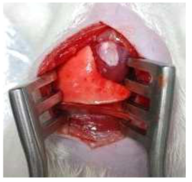 심근경색이 유도된 심장에 개발된 피브린글루를 이용해 cardiac-organoid 스캐폴드를 부착한 모습