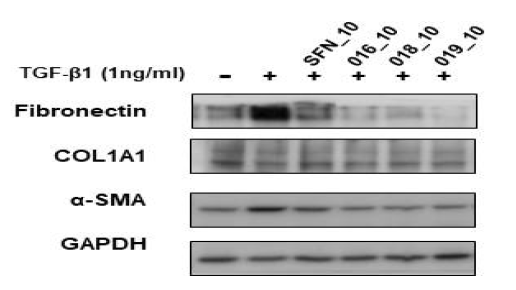 Effect of sulforaphane and active compounds on expression of extracellular matrix (ECM) proteins in TGF-β1-induced MRC-5 fibroblast cells