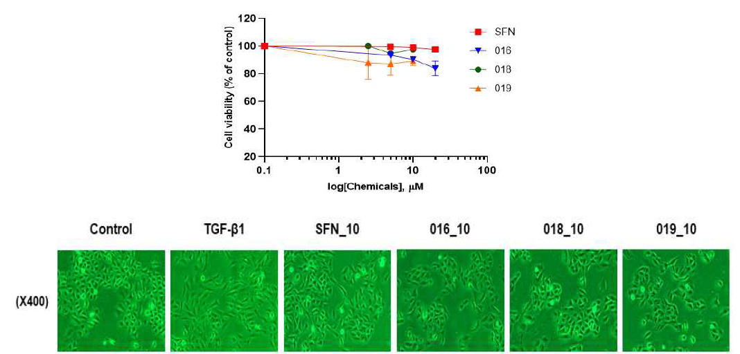 Effect of sulforaphane and active compounds on cell viability and cell morphology in A549 epithelial cells