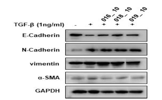 Effect of sulforaphane and active compounds on expression of extracellular matrix (ECM) proteins in TGF-β1-induced A549 epithelial cells