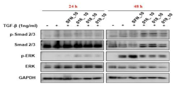 Effect of sulforaphane and active compounds on TGF-β signaling pathway in TGF-β1-induced A549 epithelial cells