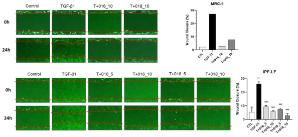 Effect of sulforaphane and active compounds on wound healing in TGF-β1-induced MRC-5 and IPF-LF cells