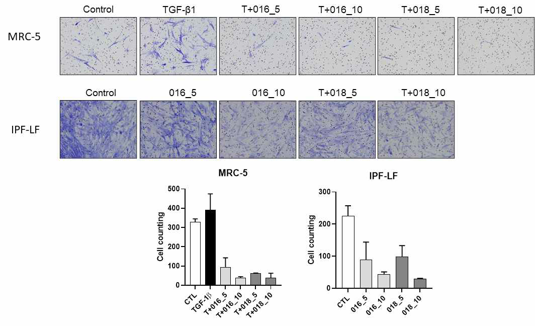 Effect of sulforaphane and active compounds on migration in TGF-β1-induced MRC-5 and IPF-LF cells