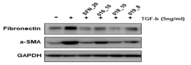 Effect of SFN and active compounds on expression of extracellular matrix (ECM) proteins in TGF-β1-induced MRC-5 fibroblast cells