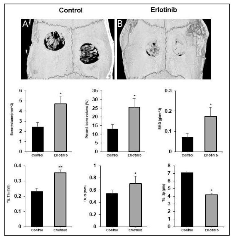 Micro-CT 분석을 통한 Erlotinib의 골 형성 증진 효능 검증