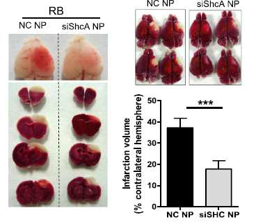 TTC staining indicating the cerebral infarct volumes in negative control siRNA-encapsulated PLGA nanoparticles and ShcA targeting siRNA-encapsulated PLGA nanoparticles