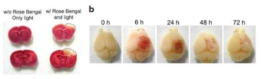 Rose-bengal induced photothrombosis
