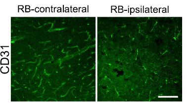 Disrupted & damaged vascular network in the mouse cortex 24hours after photothrombosis (confirmed by CD31 staining)