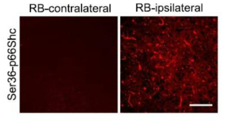 Expression of active p66shc representing ROS-induced apoptosis signaling