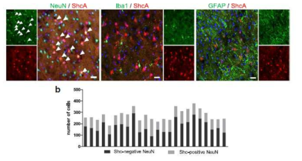 Immunohistochemical & quantitative analysis of tissue collected after 24 hour of Rose-bengal photothrombosis