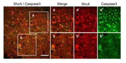 High ShcA protein-expressing cells also express caspase-3