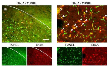 Immunohistochemical staining with anti-ShcA antibody and TUNEL
