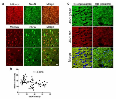 Mitochondrial dysfunction in ShcA overexpressing cells following Rose bengal photothrombosis