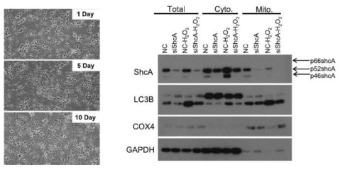 H2O2-induced expression of the Pink1 gene was reduced in ShcA siRNA group. H2O2 increased the expression of ShcA and LC3B in mitochondria indicating an increase of mitophagy