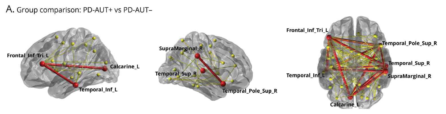 자율신경계 이상이 있는 파킨슨병 환자가 뇌의 여러 영역에서 disrupted structural connectivity를 보임