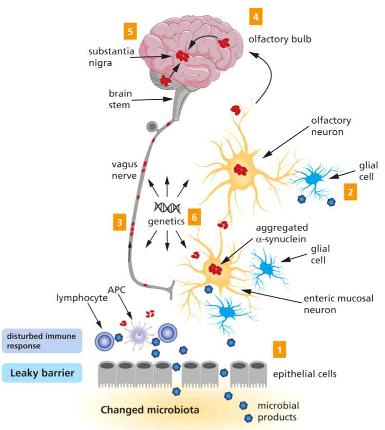α-synuclein 독성단백질이 위장관과 후각 계통에서 기원하여 뇌로 퍼져나간다는 Braak 가설 모식도. α-synuclein 독성단백질은 미주신경 (3, vagus nerve)과 후각신경구 (4, olfactory bulb)를 통하여 중추신경계로 spread 되는 것으로 알려짐