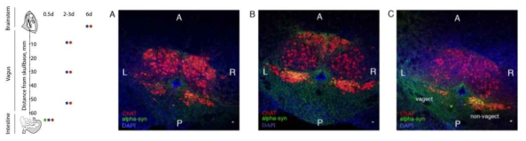 (좌) 위장관으로부터 뇌간까지 미주신경을 타고 α-synuclein 독성단백질이 전파됨. (우) 미주신경차단술이 위장관에서 유래한 α-synuclein의 전파를 막을 수 있음 (A. control 동물. B. 미주신경차단술을 시행하지 않은 파킨슨 동물 모델. C. 미주신경 차단술을 시행한 파킨슨 동물 모델)