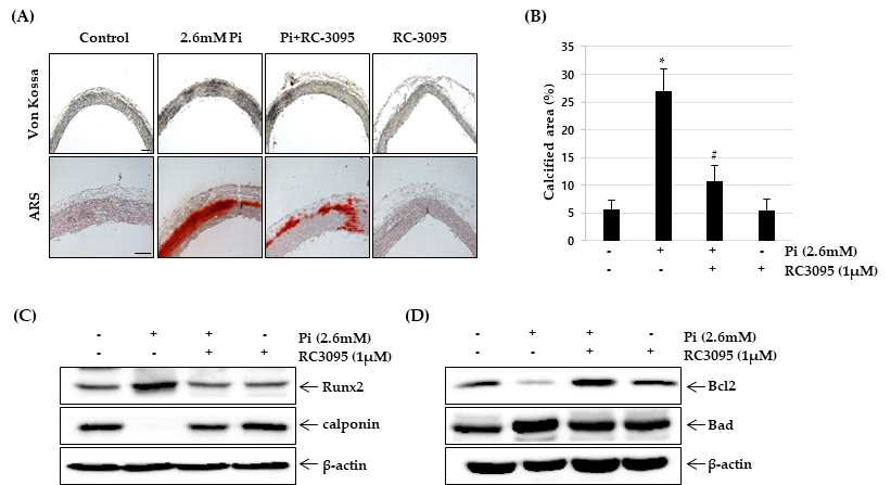 Rat 대동맥 석회화를 유도하기 위해 2.6mM Pi를 처리하고, 동시에 GRP 수용체 길항제인 RC-3095를 함께 처리하였음. 대동맥 석회화 유도 10일째에 von Kossa staining 과 ARS staining을 시행하여 석회화 정도를 확인한 결과, 2.6mM Pi에 의해 촉진된 대동맥 혈관석회화가 RC-3095처리에 의해 현저히 감소됨을 확인할 수 있었음 (A and B). 또한 대동맥 혈관석회화 모델 조직에서 단백질을 분리하여 western blot을 시행한 결과, Pi에 의해서 증가되었던 Runx2와 Bad의 발현은 RC-3095에 의해 감소되고, Pi에 의해 감소되었던 calponin과 Bcl2의 발현은 RC-3095 처리에 의해 회복되는 것을 확인할 수 있었음 (C adn D)
