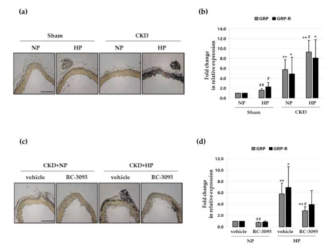 In vivo 혈관석회화에서 RC-3095의 기능을 확인하고자 adenine 사료를 섭취시켜 만성신부전 동물 모델 (Chronic kidney disease; CKD)을 제작하였음. 제작된 동물 모델에서 대동맥을 분리하여 von Kossa staining을 시행한 결과, CKD 동물 모델의 high phosphate (HP) 섭취 그룹에서 혈관석회화가 현저히 증가됨을 확인할 수 있었으며, GRP와 GRP 수용체 발현 역시 CKD+HP 그룹에서 현저히 높아지는 것을 real-time PCR을 통해 확인할 수 있었음 (A and B). 또한, CKD 동물모델에 RC-3095를 주사하여 혈관 석회화 정도를 확인한 결과, CKD+HP 그룹에서 증가되었던 혈관석회화 현상이 RC-3095에 의해 저해되는 것을 확인할 수 있었으며, 증가된 GRP와 GRP 수용체의 발현 역시 RC-3095 처리에 의해 감소되는 것을 확인할 수 있었음 (C and D). 뿐만 아니라, CKD+HP 동물모델에서 증가되었던 Runx2와 Bad의 발현은 RC-3095에 의해 감소되고, CKD+HP 동물모델에서 감소되었던 calponin과 Bcl2의 발현은 RC-3095 처리에 의해 회복되는 것을 확인할 수 있었음 (E)